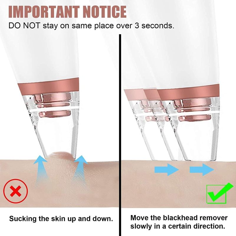 Aspirapolvere per punti neri, estrattore per pori e acne | Iper Hardware